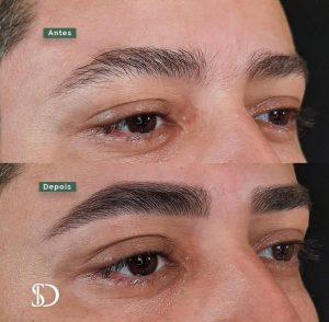 design-sobrancelhas-antes-depois-masculina-04-1024x1004